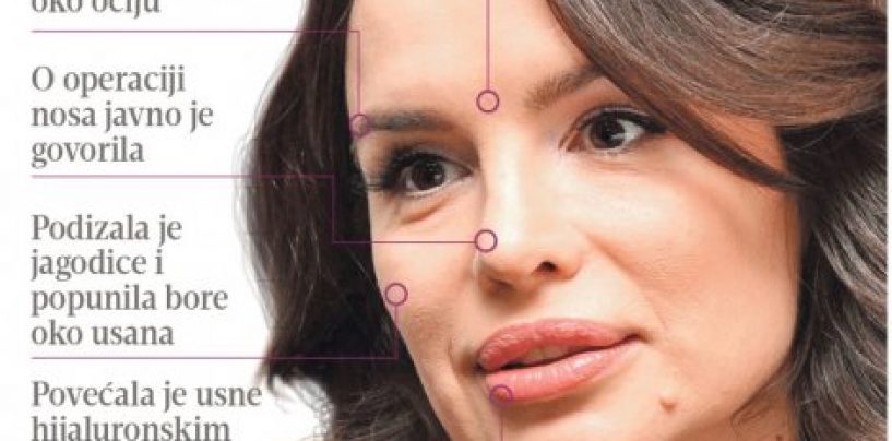 PEVAČICE NA SKENERU PLASTIČNOG HIRURGA Na Severininom licu je sve veštačko